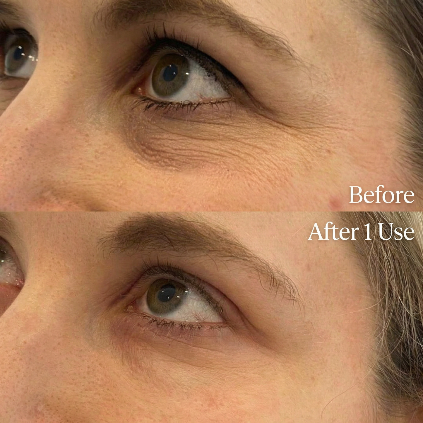 Louma™ Instant Collagen Under-Eye Patches