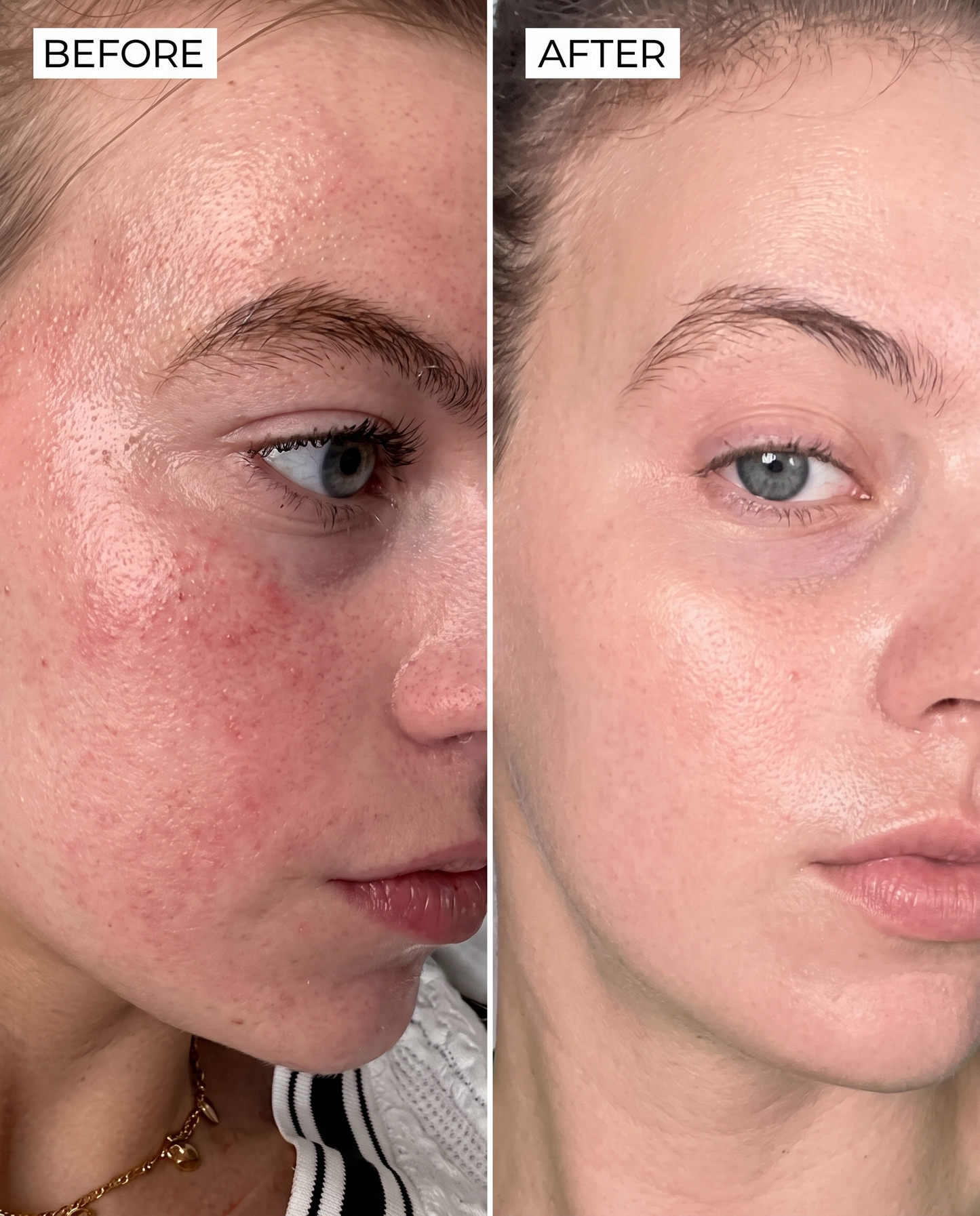 PDRN Collagen Face Mask