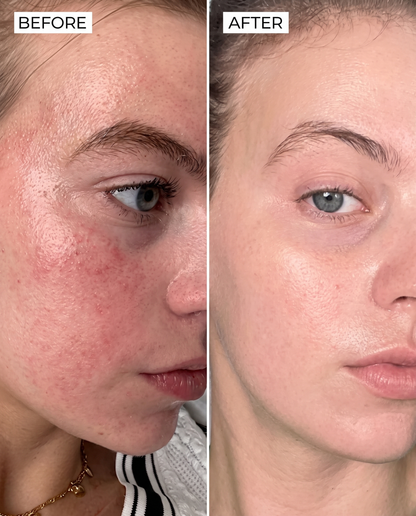 PDRN Collagen Face Mask